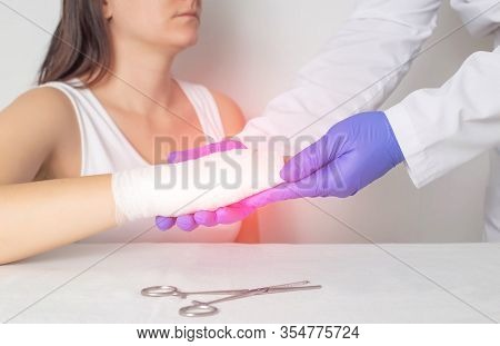 A Surgeon Doctor Examines A Patient S Palm For A Fracture Or Crack In A Bone. Scaphoid Fracture, Red