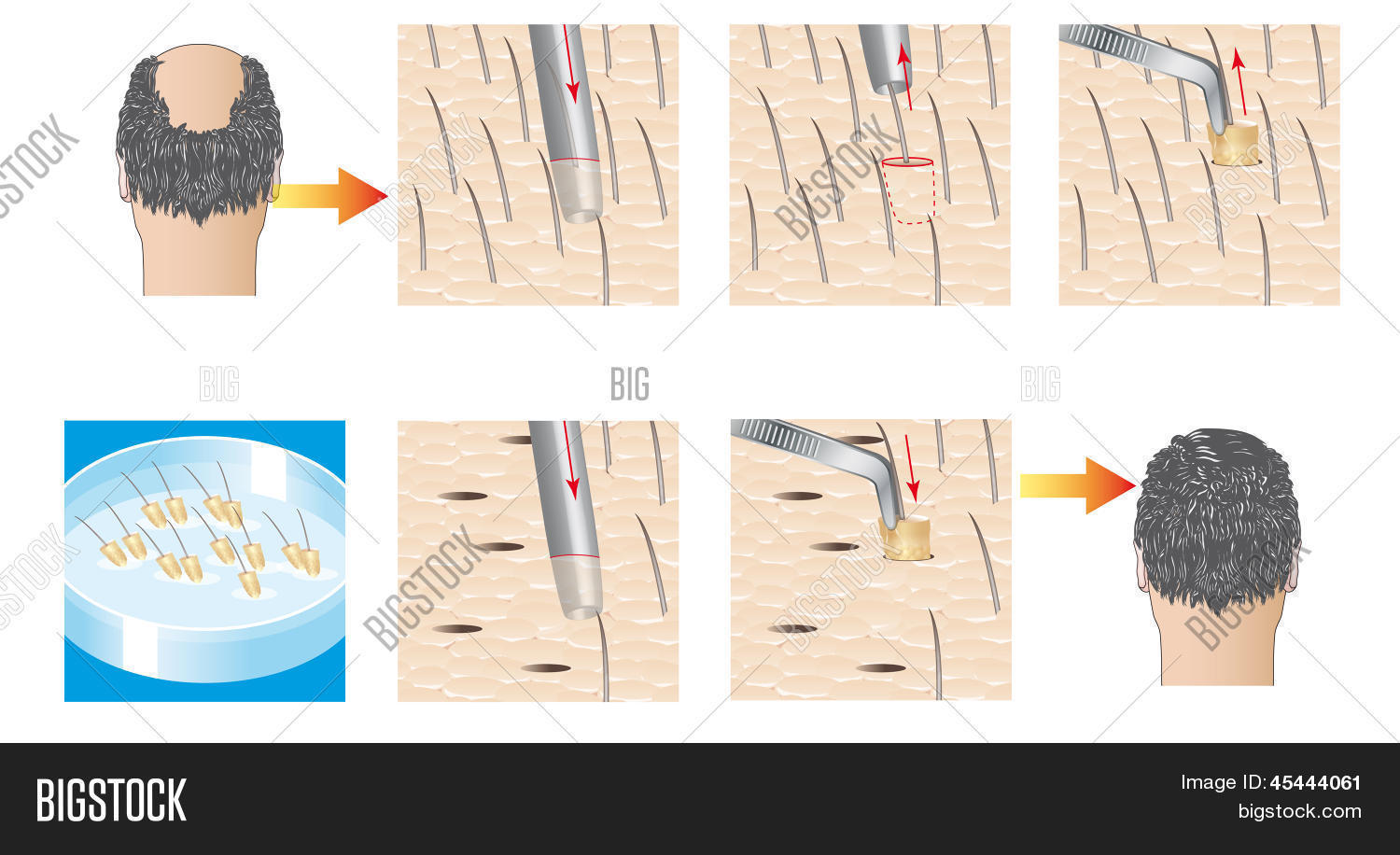 Image Preview