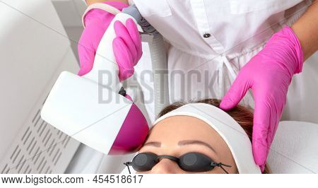 Elos Epilation Hair Removal Procedure On The Face Of A Woman. Beautician Doing Laser Rejuvenation In
