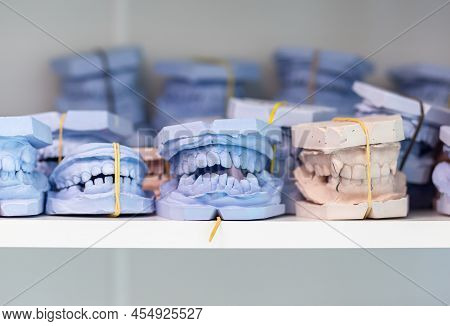 Dental Gypsum Models Cast Of A Human Dental Jaw. Gypsum Models Lie On A Shelf In A Row. Laboratory P