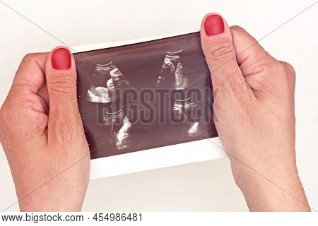 Top View Of Woman Hand Holding Ultrasound Picture Of Baby