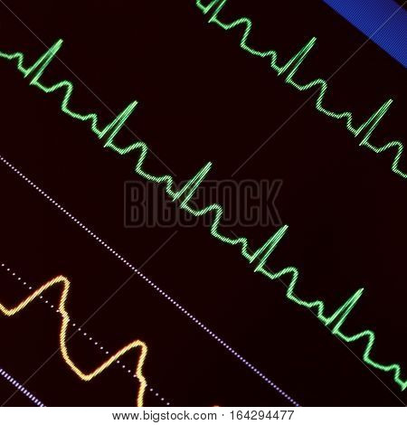 Heart monitoring in emergency care. Medical background