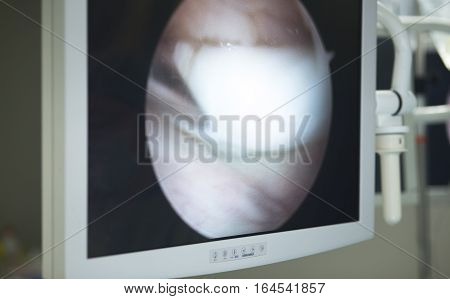 Knee Surgery Operation Screen