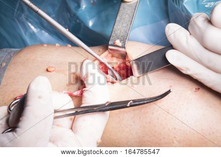 Surgical Operation Knee Surgery