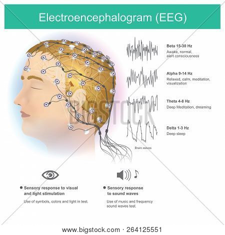 The Use Of Electrodes To Read Small Electromagnetic Waves From The Human Brain.