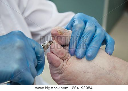 Podiatry. Diabetic Foot. Cabinet Of Foot Podiatrist