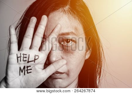 Stop Violence Against Women Campaign. Asia Woman With Bruise On Arms And Face Raised Her Hand For Di