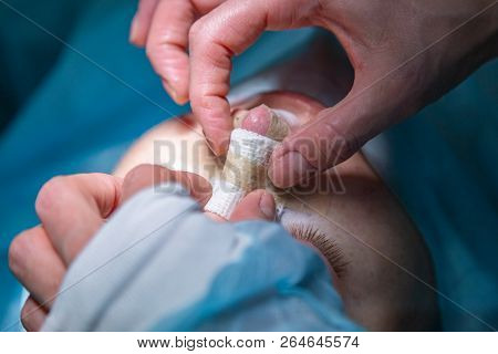 Surgeon And His Assistant Performing Cosmetic Surgery On Nose In Hospital Operating Room. Nose Resha