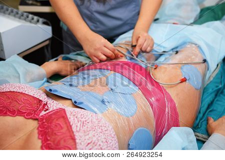 Myostimulation. Hardware Cosmetology. Body Care. Non Surgical Body Sculpting. Anti-cellulite And Ant