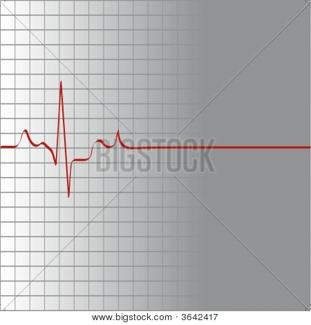 Eletrocardiograma no gráfico.