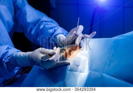 Ophthalmology Operation. Surgeons Hands In Gloves Performing Eye Vision Correction. Modern Clinic Co