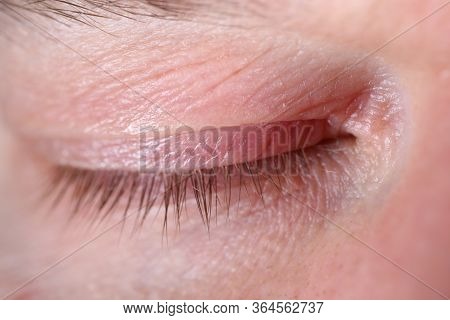 Close-up Of Middle-aged Man Closed Eye. Macro Shot Of Tiny Wrinkles On Senior Male Skin. Cant See An