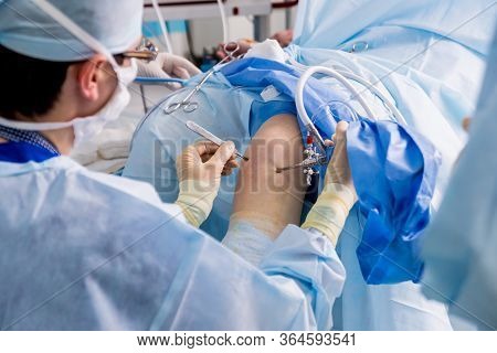 Arthroscope Surgery. Orthopedic Surgeons In Teamwork In The Operating Room