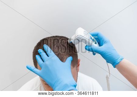 Trichoscopy Of Hair And Scalp Closeup. Trichoscope In The Hands Of A Doctor