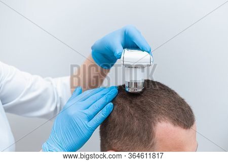 Trichoscopy Of Hair And Scalp Closeup. Trichoscope In The Hands Of A Doctor