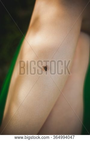 House-fly Sits On A Female Foot. House Fly, Food Contamination Hygiene Concept. The Flies Are Insect