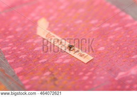 Biopsy Samples Being Processed At The Pathology Laboratory To Be Embedded In Paraffin For Analysis.