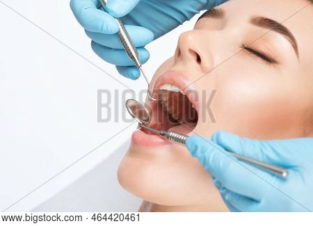 A Dentist Doctor Treats Caries On A Tooth Of A Young Beautiful Woman In A Dental Clinic. Tooth Filli