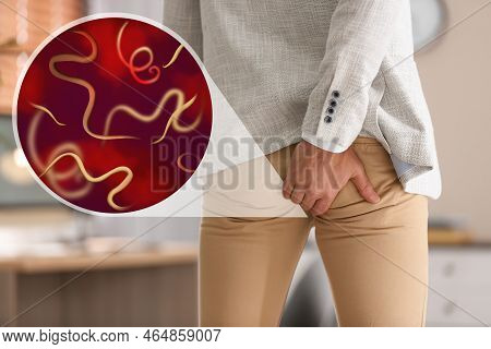 Parasites Under Microscope And Man Suffering From Helminthiasis, Closeup