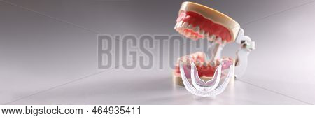 Close-up Of Tooth Model And Aligner Teeth Orthodontic Dental Model Or Human Jaw. Model For Education