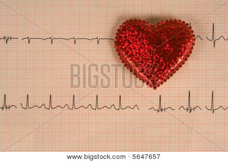 ELECTROCARDIOGRAMA