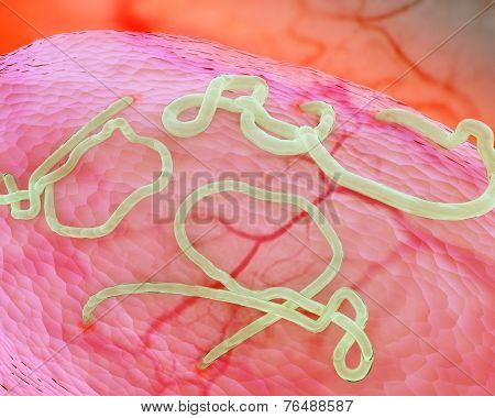 Ebola Virus Attacking Cell