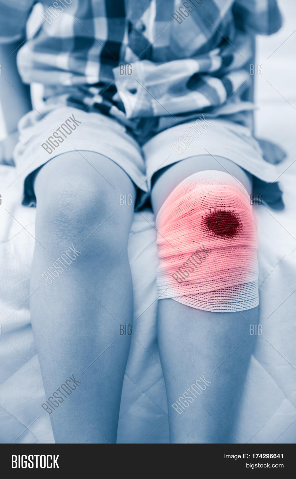 Child Injured. Wound Image & Photo (Free Trial) Bigstock