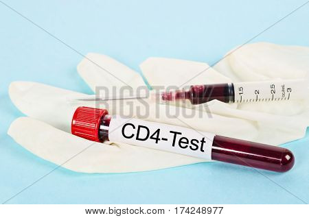 Blood sample in tube for CD4 cell testing Immunology cell in HIV infected people