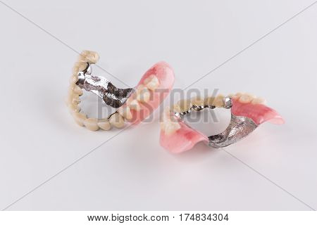 Clasp prosthesis with and attachments fixing ceramic crowns