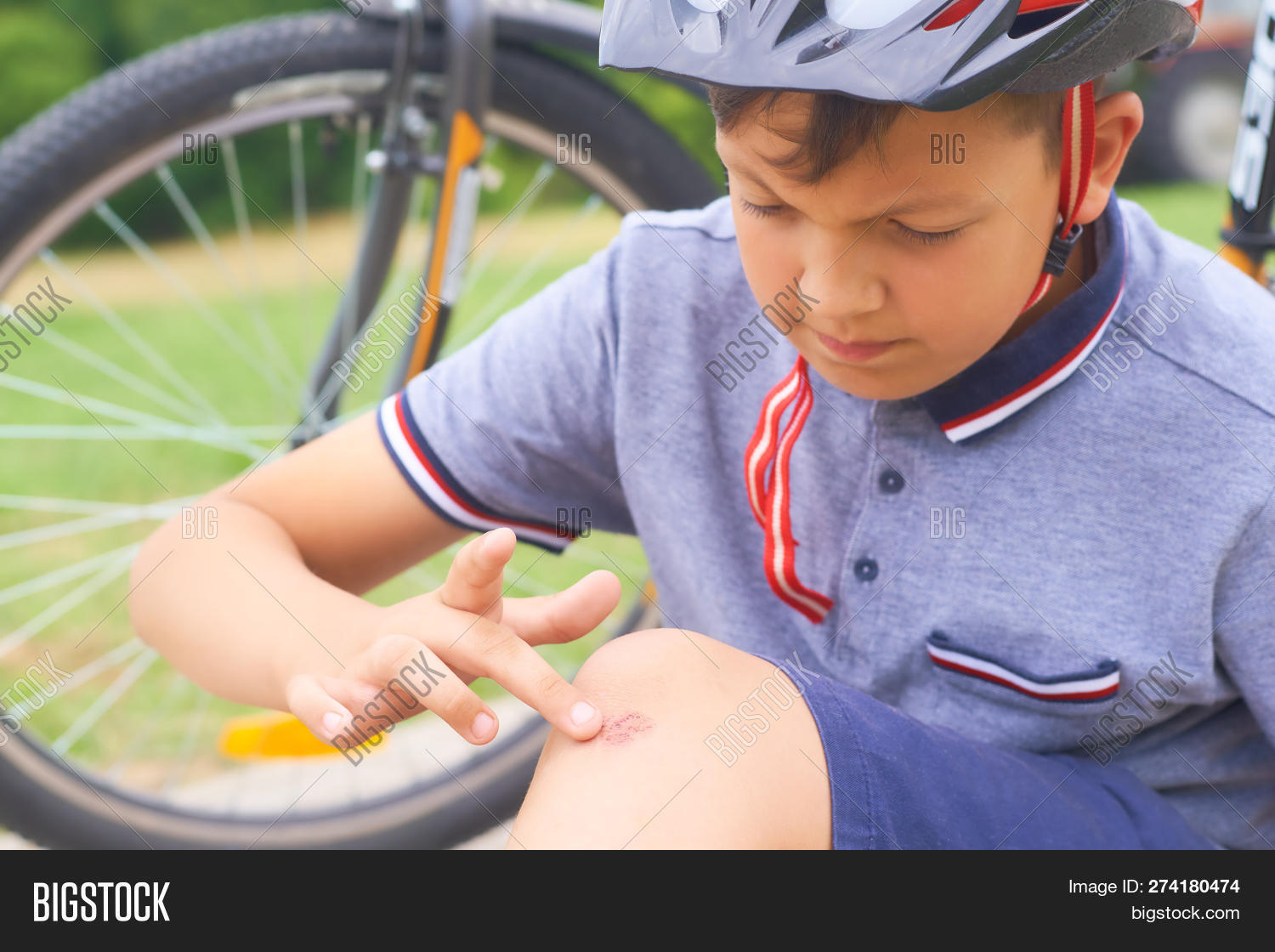 Boy Scraped Knee Image & Photo (Free Trial) Bigstock
