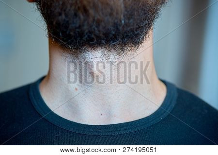 Male Body Parts, Beard And Adams Apple, Close-up