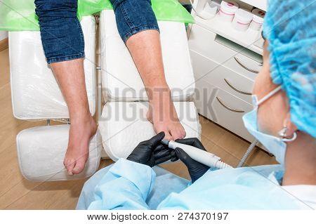 Podology Treatment. Podiatrist Treats Foot. Podiatry Doctor Or Dermatologist Treats The Patient In M