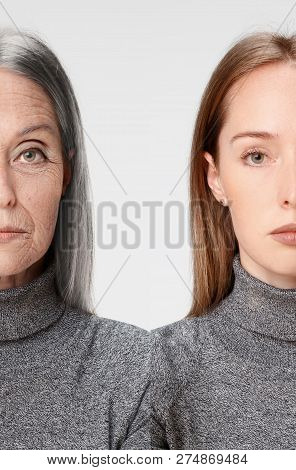 Comparison. Portrait Of Beautiful Woman With Problem And Clean Skin, Aging And Youth Concept, Beauty