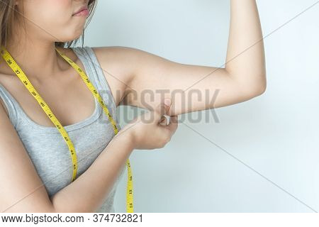 Woman Pulling Her Upper Arm And Displeased With Fat Excess Cellulite On Her Arm.