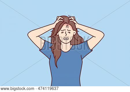 Woman Suffers From Itchy Head After Fungal Infection And Dandruff Associated With Poor-quality Hair 