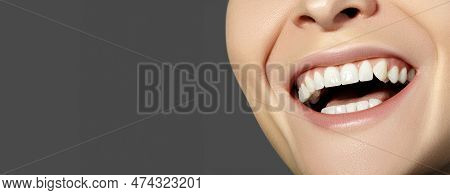 Dental Beauty. Beautiful Macro With Perfect White Teeth. Whitening Tooth, Wellness Treatment