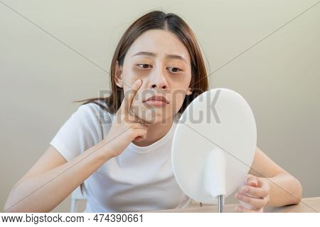 Bored, Insomnia Asian Young Woman, Girl Looking At Mirror, Without Makeup, Touch Under Eyes With Pro