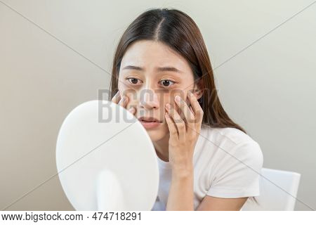 Bored, Insomnia Asian Young Woman, Girl Looking At Mirror, Without Makeup, Touch Under Eyes With Pro
