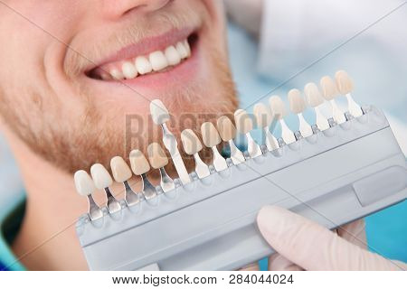 Dentist Selecting Patient's Teeth Color With Palette In Clinic, Closeup
