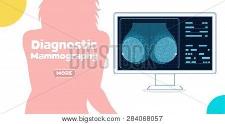 Diagnostic Mammography Banner. Female Health Care Concept. Mammography Examination Procedure In Mode