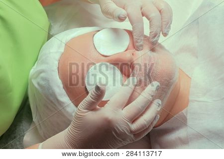 Woman On The Procedure In The Cosmetology Center. Eyes Closed With Cotton Pads. A Beautician Or A Do
