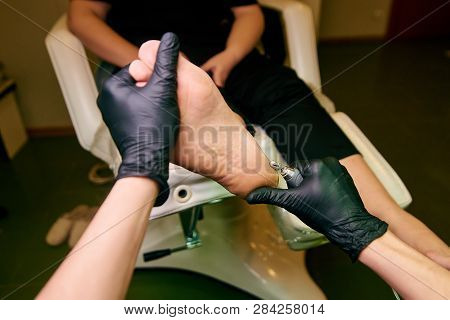 Podology, Treatment Of The Affected Areas Of The Feet, Medical Office, Pedicure
