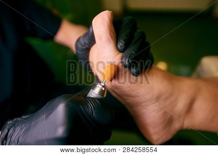 Podology, Treatment Of The Affected Areas Of The Feet, Medical Office, Pedicure