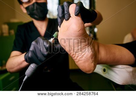 Podology, Treatment Of The Affected Areas Of The Feet, Medical Office, Pedicure