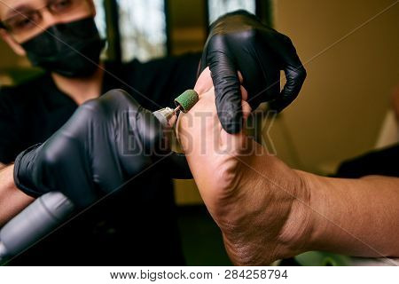 Podology, Treatment Of The Affected Areas Of The Feet, Medical Office, Pedicure