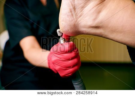Podology, Treatment Of The Affected Areas Of The Feet, Medical Office, Pedicure