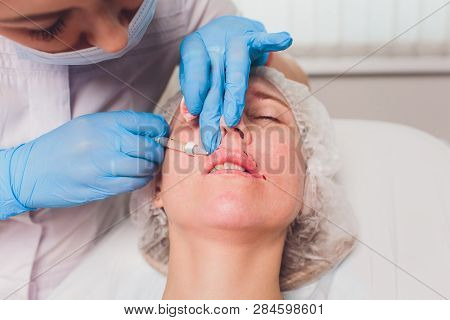 The Doctor Cosmetologist Makes Lip Augmentation Procedure Of A Beautiful Woman In A Beauty Salon.cos