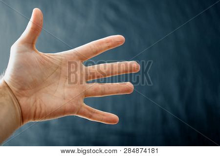 Adult Hand With Raynaud's Syndrome - Phenomenon. Close Up Hand With Fingers On Dark Background With 