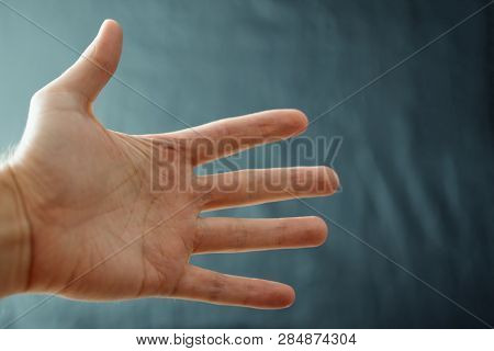 Adult Hand With Raynaud's Syndrome - Phenomenon. Close Up Hand With Fingers On Dark Background With 