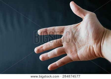 Adult Hand With Raynaud's Syndrome - Phenomenon. Close Up Hand With Fingers On Dark Background With 